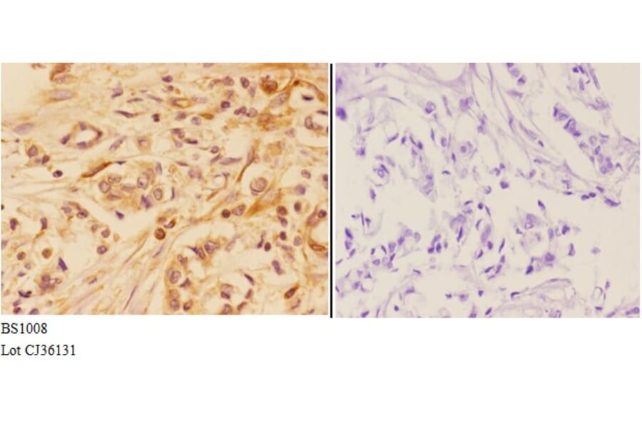 Anti-AKT (P467) Antibody from Bioworld Technology (BS1008) - Antibodies.com