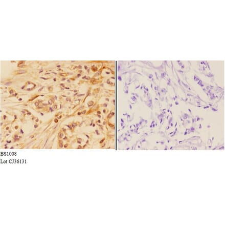 Anti-AKT (P467) Antibody from Bioworld Technology (BS1008) - Antibodies.com