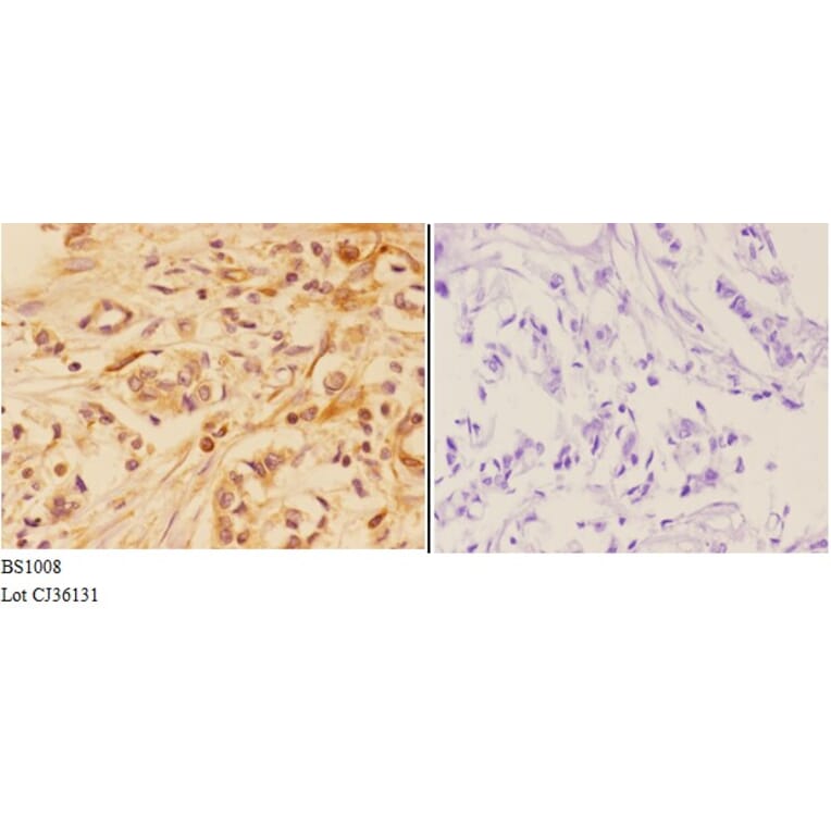 Anti-AKT (P467) Antibody from Bioworld Technology (BS1008) - Antibodies.com