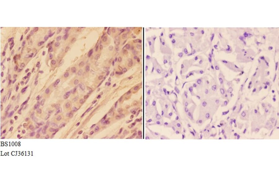 Anti-AKT (P467) Antibody from Bioworld Technology (BS1008) - Antibodies.com