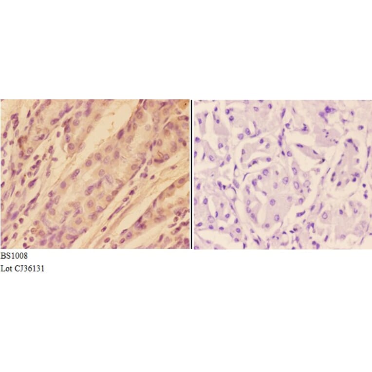 Anti-AKT (P467) Antibody from Bioworld Technology (BS1008) - Antibodies.com