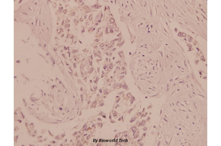 Anti-AMPKα1/2 (D168) Antibody from Bioworld Technology (BS1009) - Antibodies.com