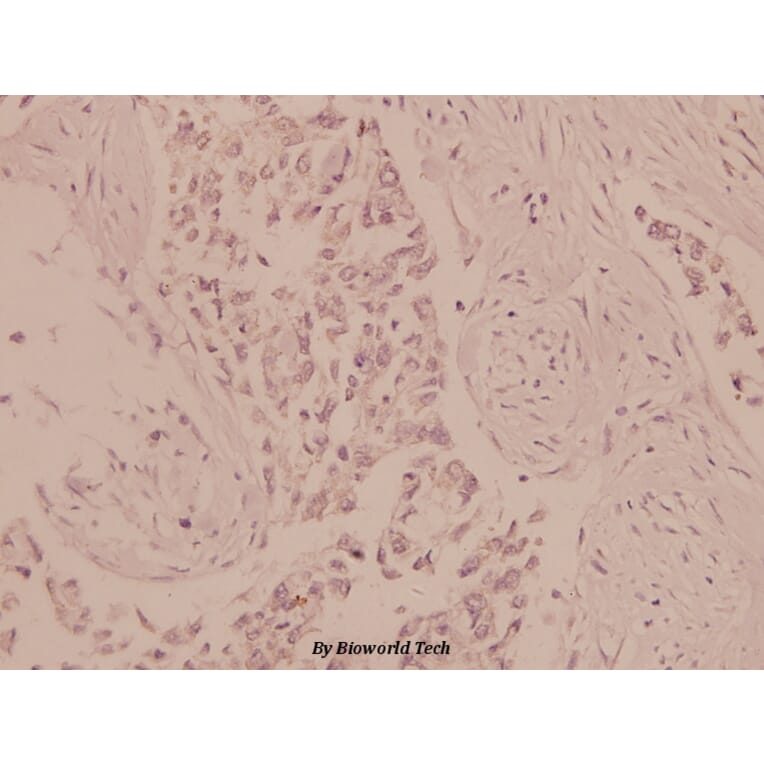 Anti-AMPKα1/2 (D168) Antibody from Bioworld Technology (BS1009) - Antibodies.com