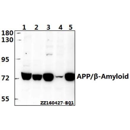 Anti-APP/β-Amyloid (E737) Antibody from Bioworld Technology (BS1011) - Antibodies.com