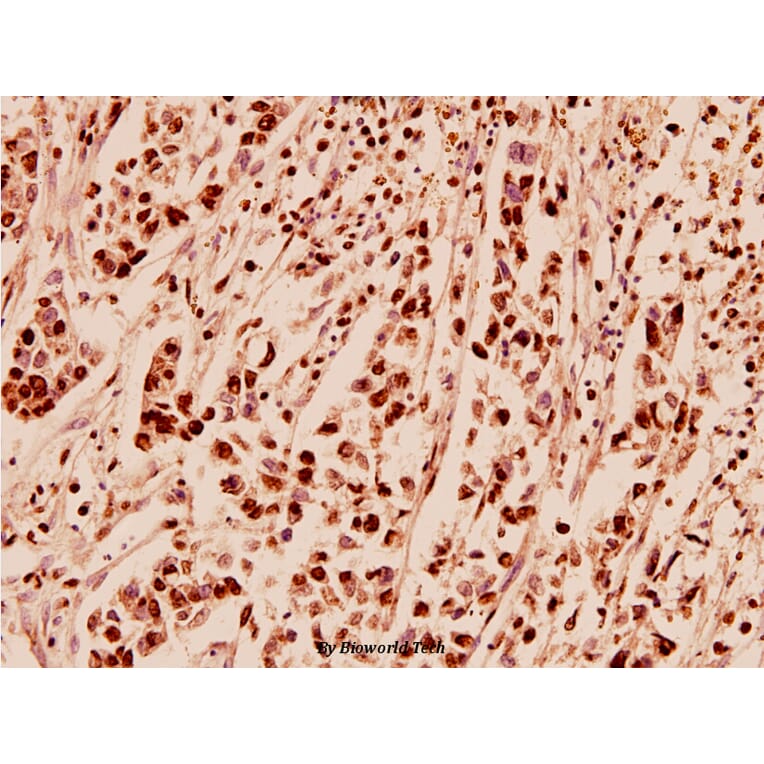 Anti-APP/β-Amyloid (E737) Antibody from Bioworld Technology (BS1011) - Antibodies.com