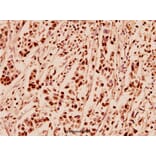 Anti-APP/β-Amyloid (E737) Antibody from Bioworld Technology (BS1011) - Antibodies.com
