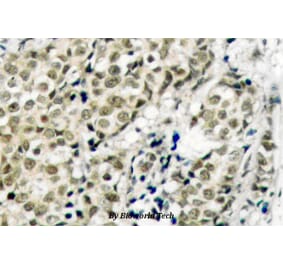 Anti-AR (G207) Antibody from Bioworld Technology (BS1012) - Antibodies.com