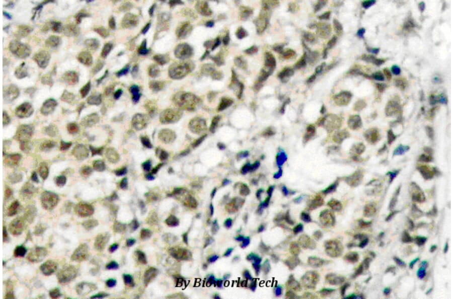 Anti-AR (G207) Antibody from Bioworld Technology (BS1012) - Antibodies.com