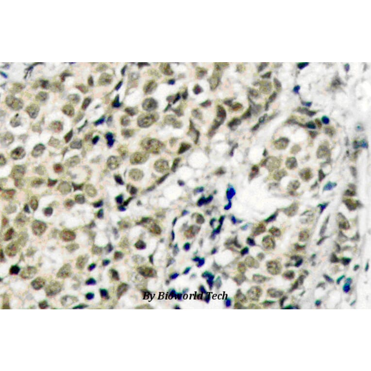 Anti-AR (G207) Antibody from Bioworld Technology (BS1012) - Antibodies.com