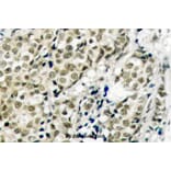 Anti-AR (G207) Antibody from Bioworld Technology (BS1012) - Antibodies.com