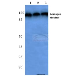 Anti-AR (E646) Antibody from Bioworld Technology (BS1013) - Antibodies.com