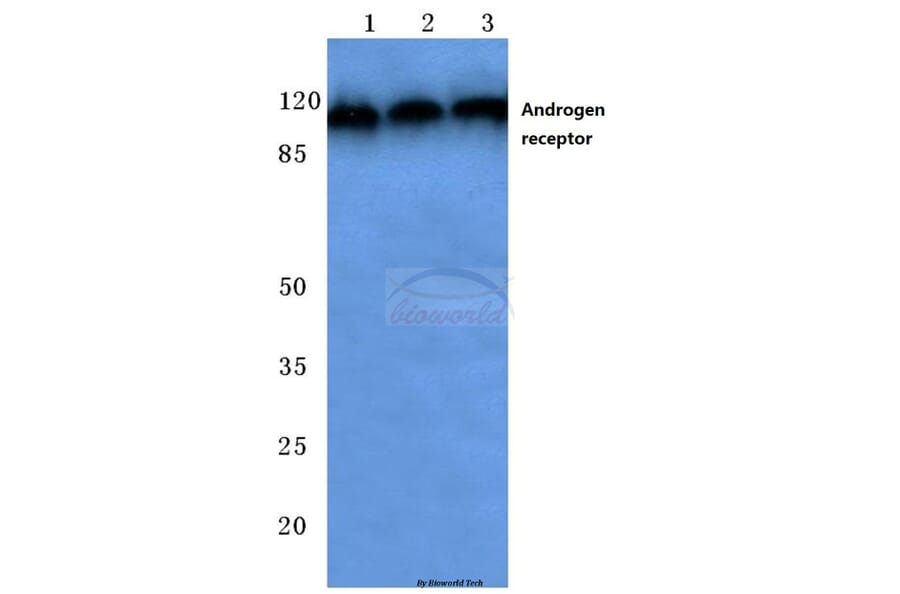 Anti-AR (E646) Antibody from Bioworld Technology (BS1013) - Antibodies.com