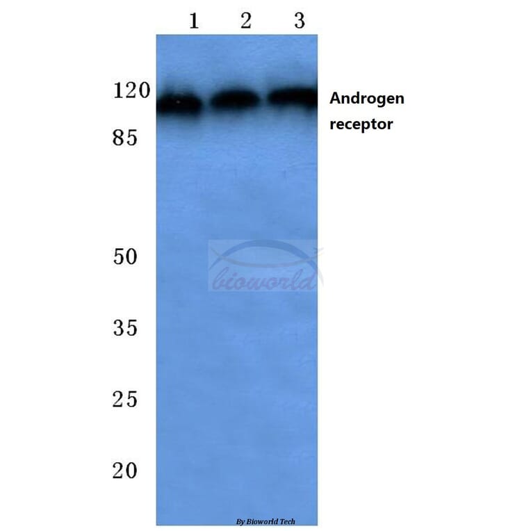 Anti-AR (E646) Antibody from Bioworld Technology (BS1013) - Antibodies.com