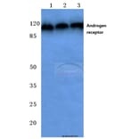 Anti-AR (E646) Antibody from Bioworld Technology (BS1013) - Antibodies.com