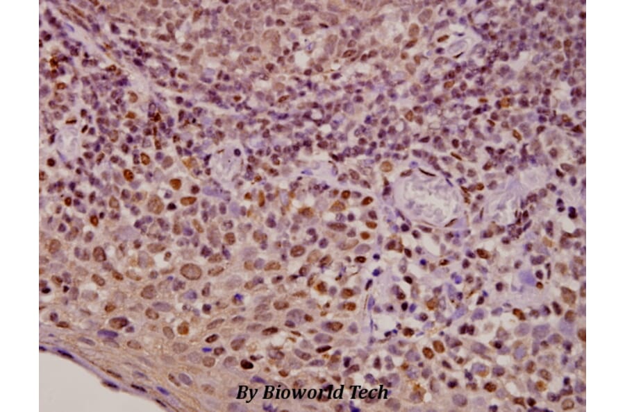 Anti-AR (E646) Antibody from Bioworld Technology (BS1013) - Antibodies.com