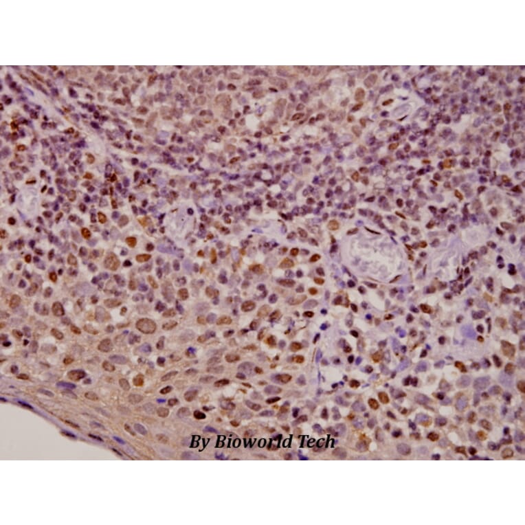 Anti-AR (E646) Antibody from Bioworld Technology (BS1013) - Antibodies.com