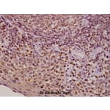Anti-AR (E646) Antibody from Bioworld Technology (BS1013) - Antibodies.com
