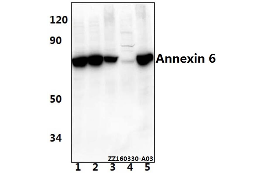 Anti-Annexin VI (A5) Antibody from Bioworld Technology (BS1014) - Antibodies.com