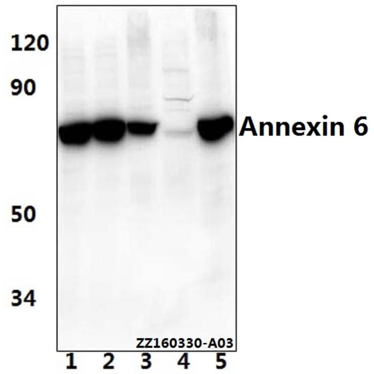 Anti-Annexin VI (A5) Antibody from Bioworld Technology (BS1014) - Antibodies.com