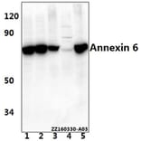 Anti-Annexin VI (A5) Antibody from Bioworld Technology (BS1014) - Antibodies.com