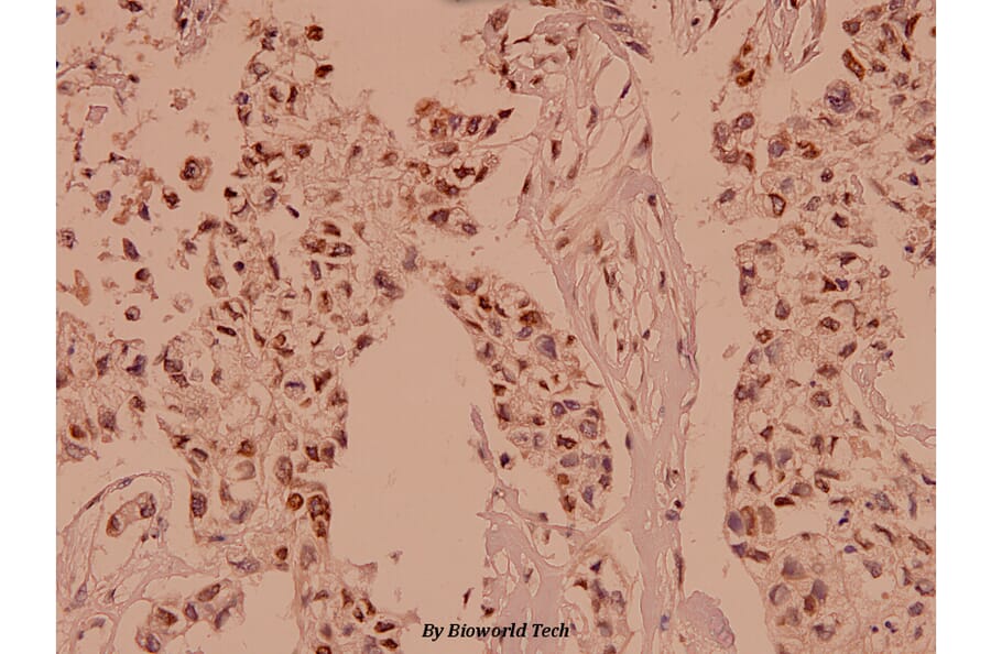 Anti-APC (Q2829) Antibody from Bioworld Technology (BS1017) - Antibodies.com