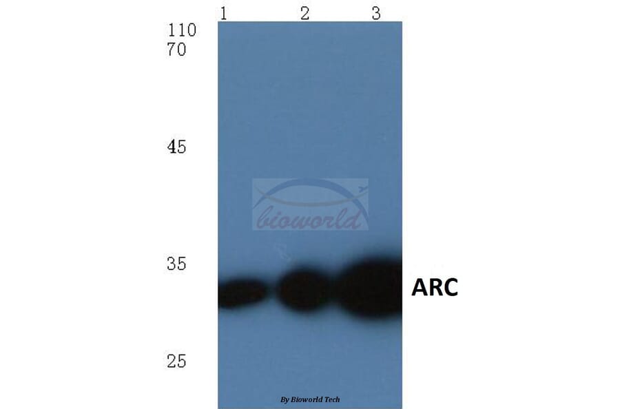 Anti-ARC (E194) Antibody from Bioworld Technology (BS1018) - Antibodies.com