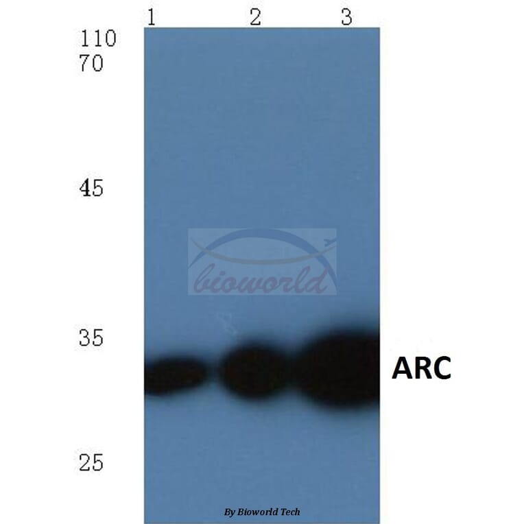 Anti-ARC (E194) Antibody from Bioworld Technology (BS1018) - Antibodies.com