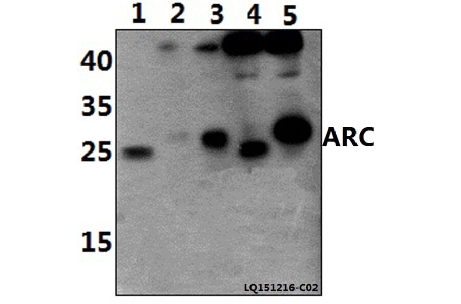 Anti-ARC (E194) Antibody from Bioworld Technology (BS1018) - Antibodies.com