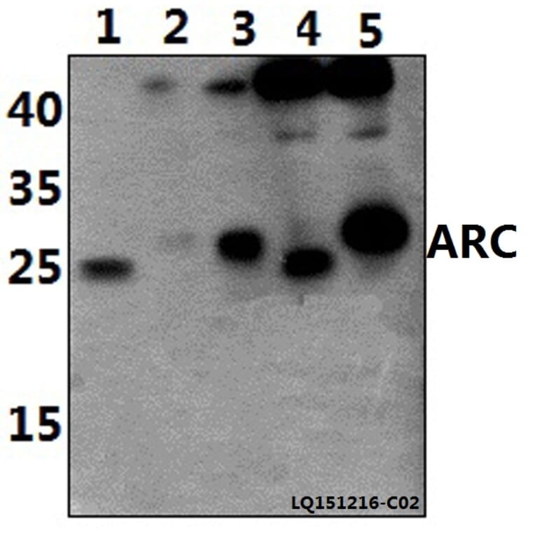 Anti-ARC (E194) Antibody from Bioworld Technology (BS1018) - Antibodies.com