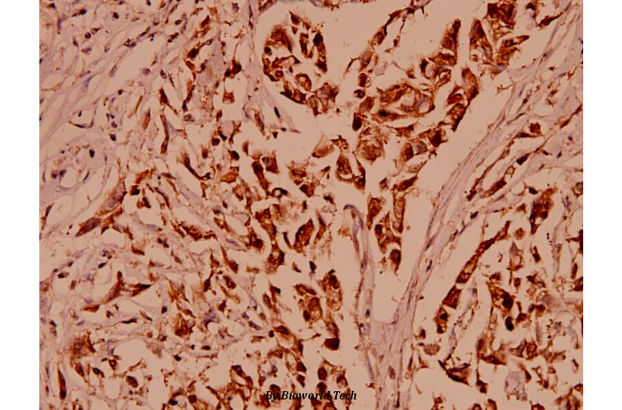 Anti-ARC (E194) Antibody from Bioworld Technology (BS1018) - Antibodies.com