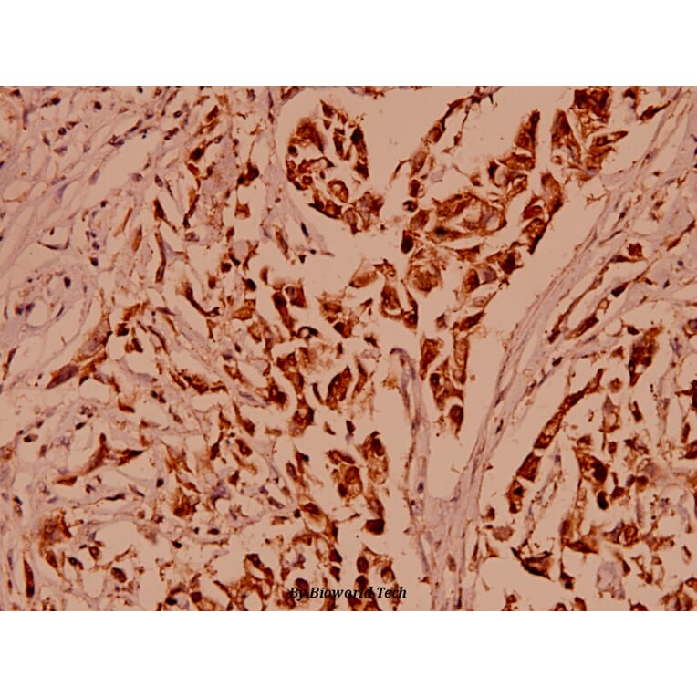Anti-ARC (E194) Antibody from Bioworld Technology (BS1018) - Antibodies.com