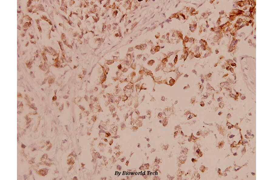 Anti-ASK1 (T77) Antibody from Bioworld Technology (BS1019) - Antibodies.com