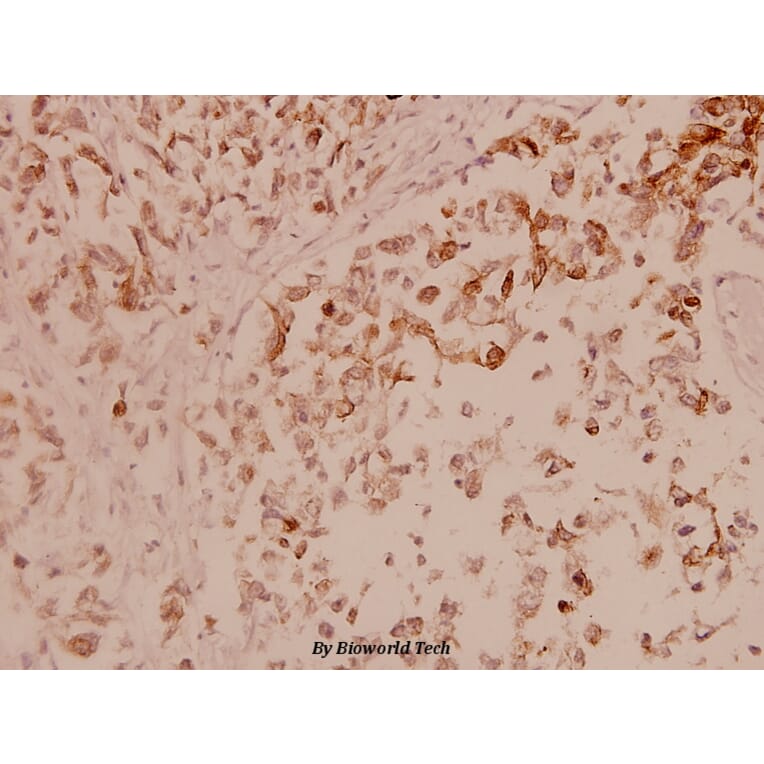 Anti-ASK1 (T77) Antibody from Bioworld Technology (BS1019) - Antibodies.com