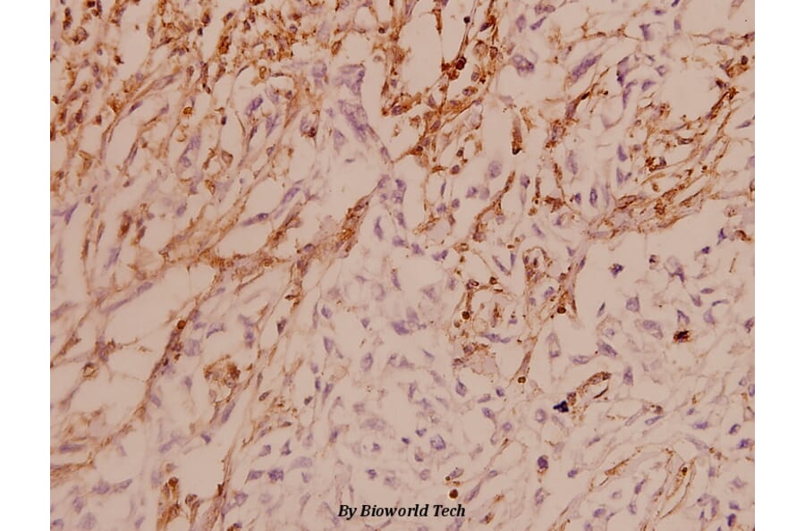 Anti-ASK1 (E960) Antibody from Bioworld Technology (BS1020) - Antibodies.com
