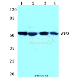 Anti-ATF2 (K106) Antibody from Bioworld Technology (BS1021) - Antibodies.com