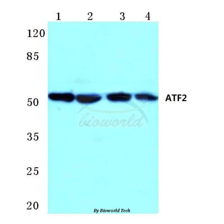 Anti-ATF2 (K106) Antibody from Bioworld Technology (BS1021) - Antibodies.com