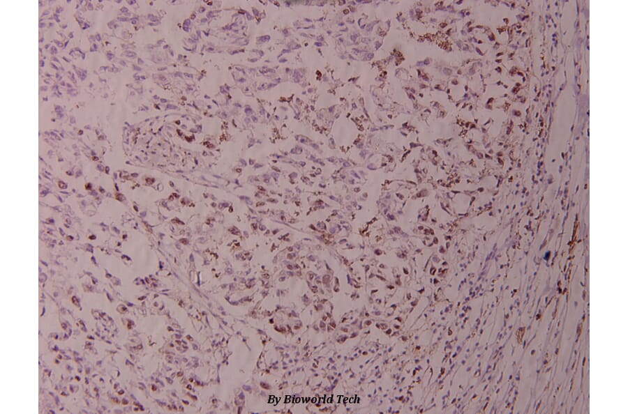 Anti-ATF2 (K106) Antibody from Bioworld Technology (BS1021) - Antibodies.com