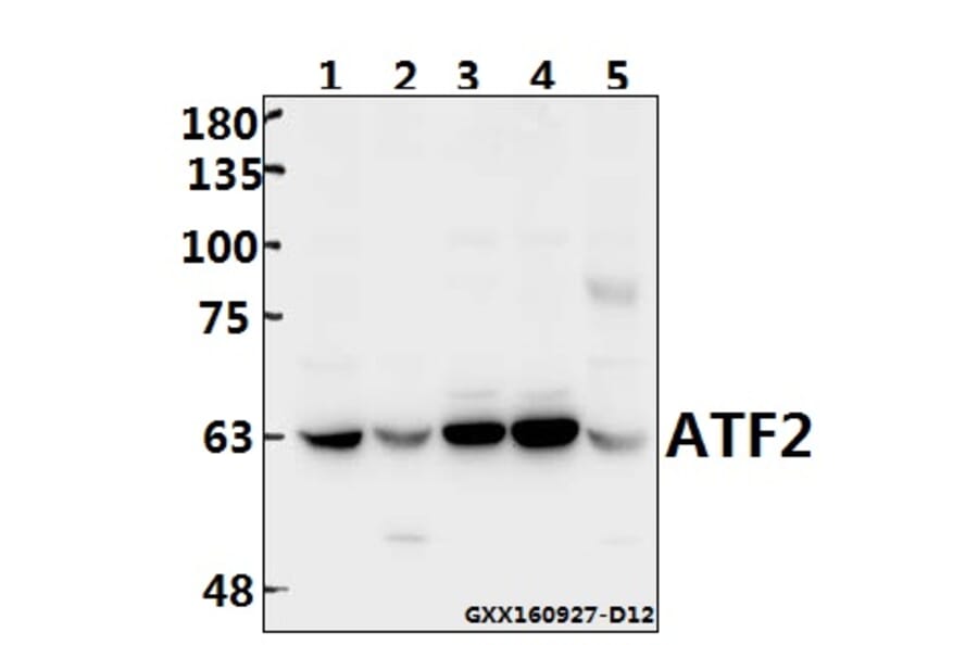 Anti-ATF2 (G56) Antibody from Bioworld Technology (BS1022) - Antibodies.com
