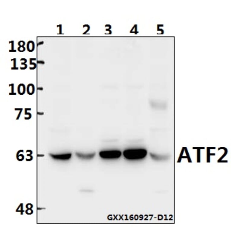 Anti-ATF2 (G56) Antibody from Bioworld Technology (BS1022) - Antibodies.com