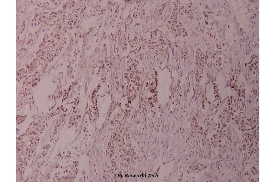 Anti-ATF2 (G56) Antibody from Bioworld Technology (BS1022) - Antibodies.com
