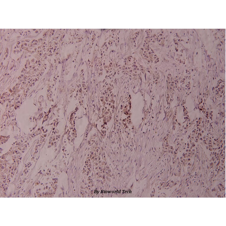 Anti-ATF2 (G56) Antibody from Bioworld Technology (BS1022) - Antibodies.com