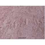 Anti-ATF2 (G56) Antibody from Bioworld Technology (BS1022) - Antibodies.com