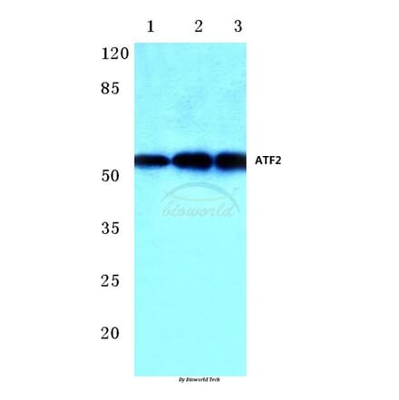 Anti-ATF2 (V63) Antibody from Bioworld Technology (BS1023) - Antibodies.com