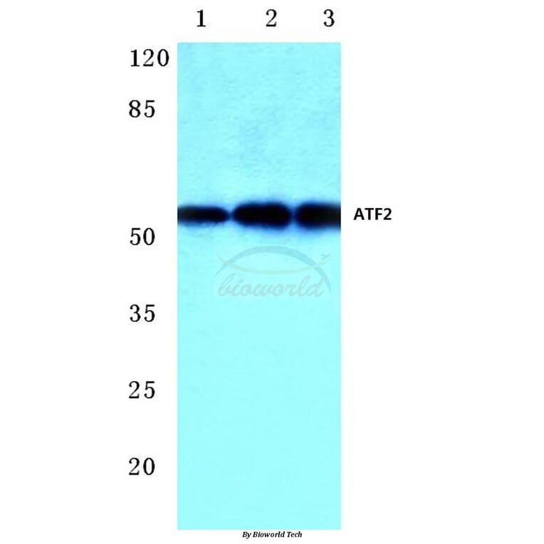 Anti-ATF2 (V63) Antibody from Bioworld Technology (BS1023) - Antibodies.com