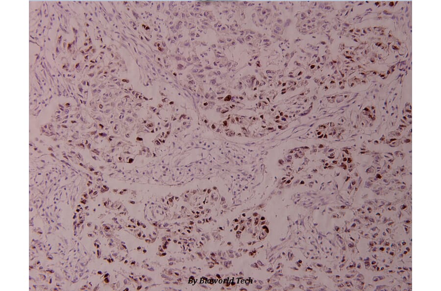 Anti-ATF2 (V63) Antibody from Bioworld Technology (BS1023) - Antibodies.com
