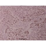 Anti-ATF2 (V63) Antibody from Bioworld Technology (BS1023) - Antibodies.com