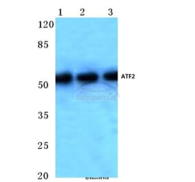 Anti-ATF2 (V65) Antibody from Bioworld Technology (BS1024) - Antibodies.com