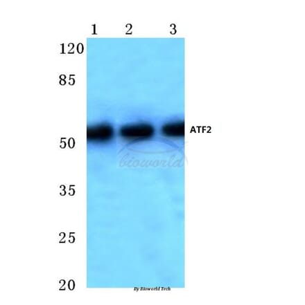 Anti-ATF2 (V65) Antibody from Bioworld Technology (BS1024) - Antibodies.com