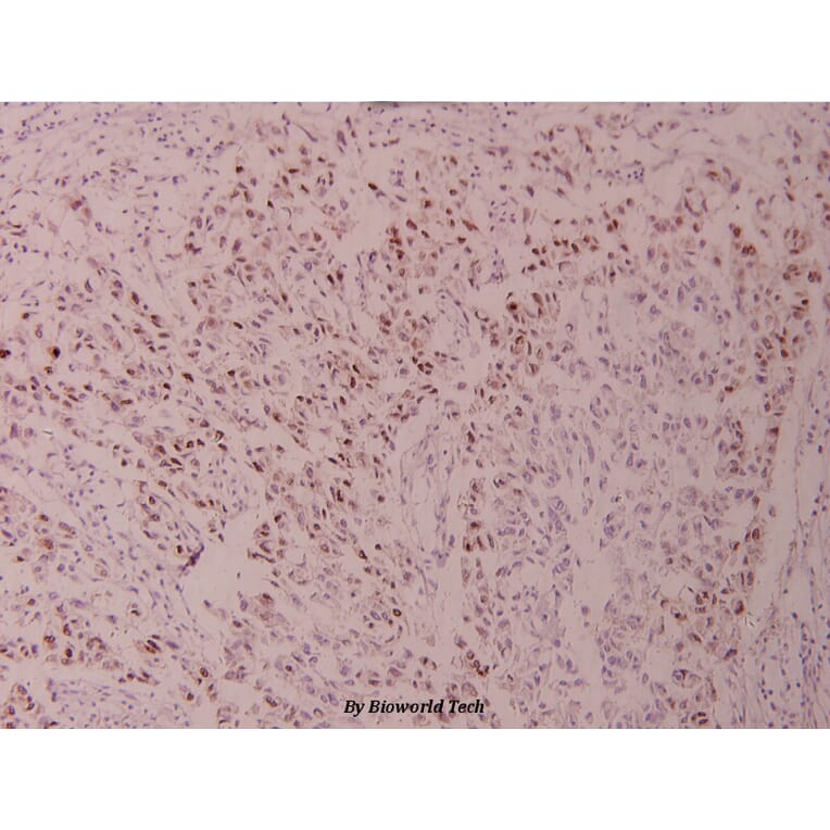 Anti-ATF2 (V65) Antibody from Bioworld Technology (BS1024) - Antibodies.com