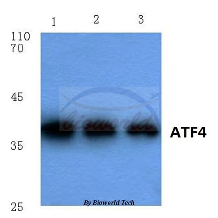 Anti-ATF4 (R239) Antibody from Bioworld Technology (BS1026) - Antibodies.com